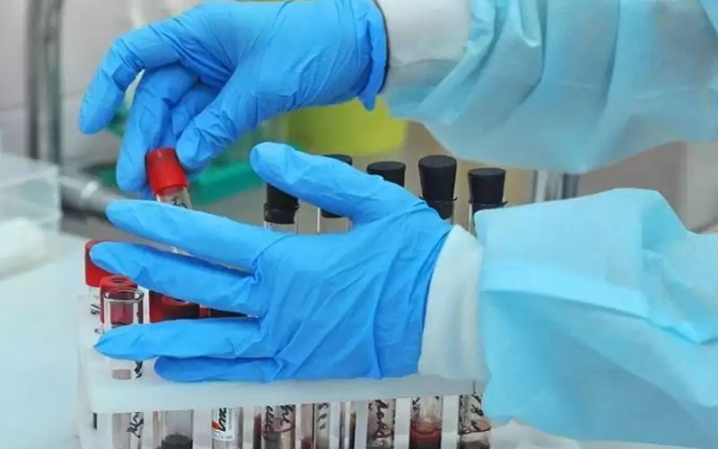 روسيا: نصمم دواء ضد كورونا على