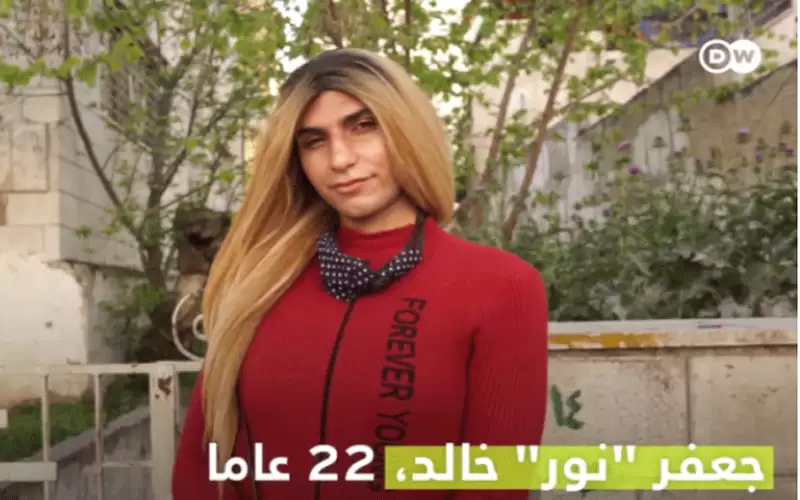 بالفيديو .. فتاة اردنية خلقت بتشوهات
