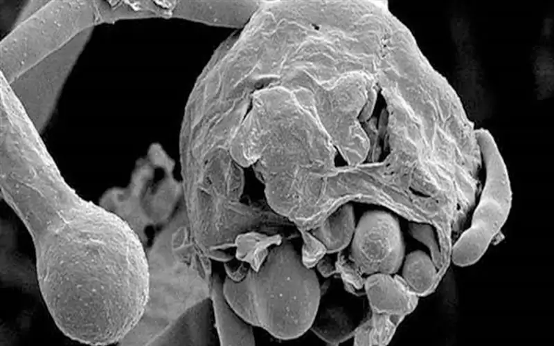 وفاة جديدة بالفطر الأسود بالعراق