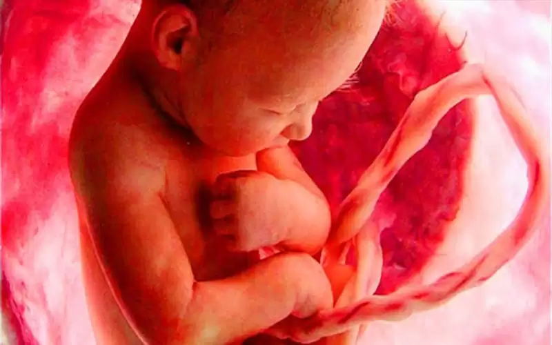 متلازمة تورش وعلاقتها بحدوث إعاقات الأطفال