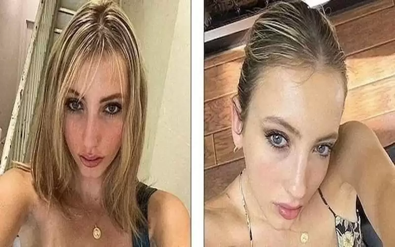 تكتشف بأن قلبها على اليمين بالصدفة