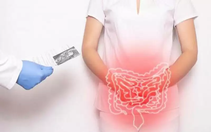 انفجار القولون: الأسباب، الأعراض، طرق العلاج