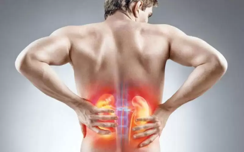 شراب ساخن يخلص الإنسان من حصوات