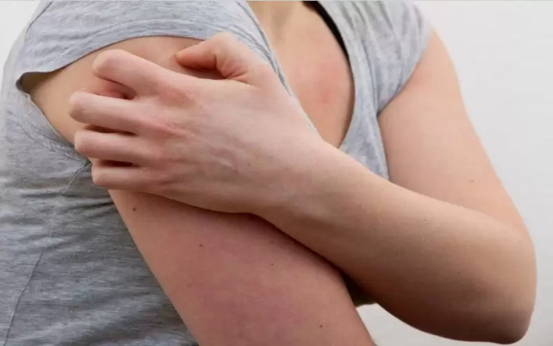 لماذا نشعر بالحكة الشديدة؟