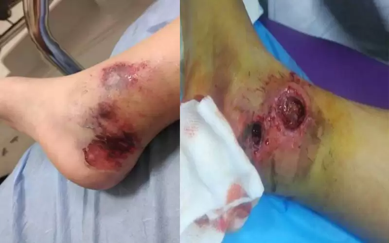 ذوو جوري لـنيسان: العفن وصل الأنسجة..