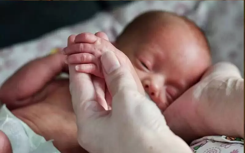 ولادة طفل بحالة وراثية نادرة تمنعه