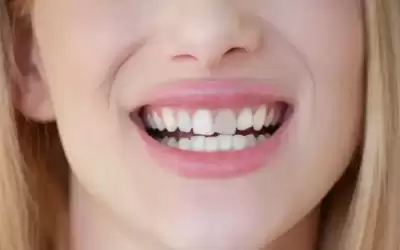 ما أسباب ظهور البقع على الأسنان؟
