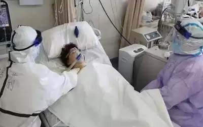 شركس: انخفاض واضح بإصابات الإنفلونزا خلال