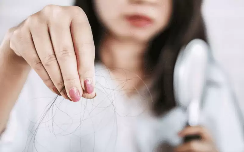 الأطعمة المسؤولة عن تسريع تساقط الشعر