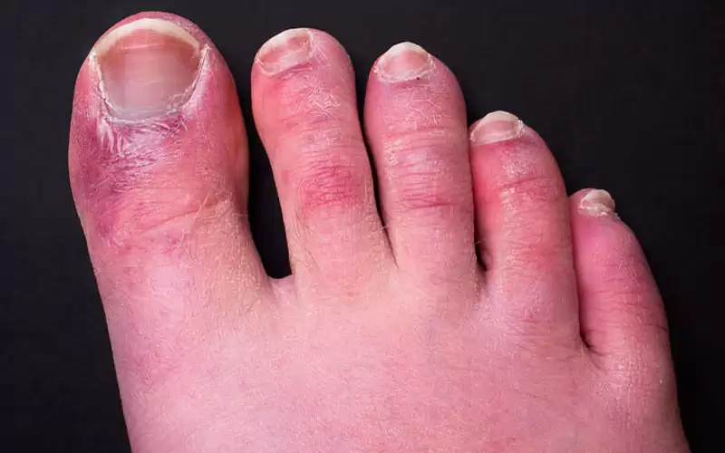 دراسة تكشف السبب الكامن وراء ظهور