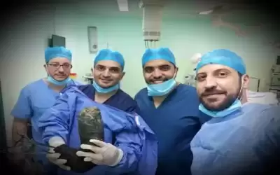 إزالة 6 كغم شعر من بطن