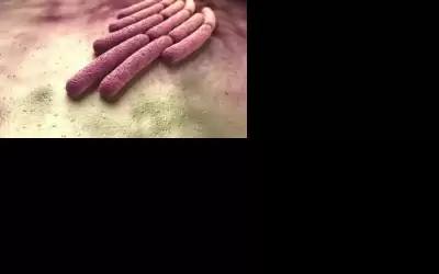 الخرابشة للتقصي الوبائي: خلوا الكوليرا ببالكوا
