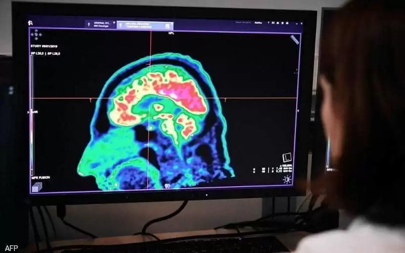 علماء يكتشفون مسار تفشي الزهايمر في