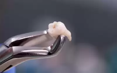 وفاة عشرينية بعد خلع ضرس في