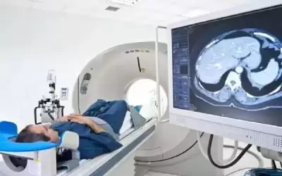 5 علامات تنذر بقرب الجلطة الدماغية