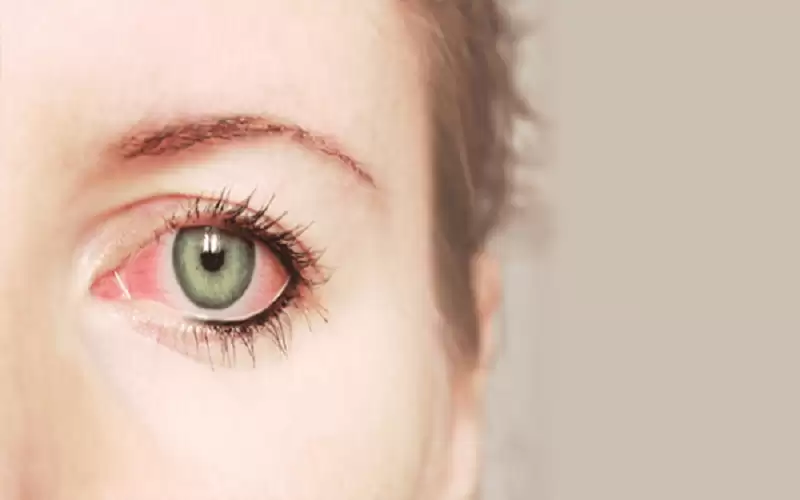 الكشف عن علامات في العين قد