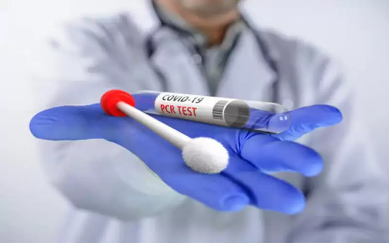 توضيح حكومي حول تأخر نتائج فحوصات