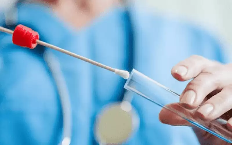 91.2 % نسبة الشفاء من كورونا