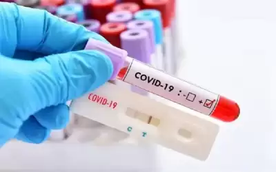 نقيب الصيادلة يدعو للسماح ببيع فحوصات