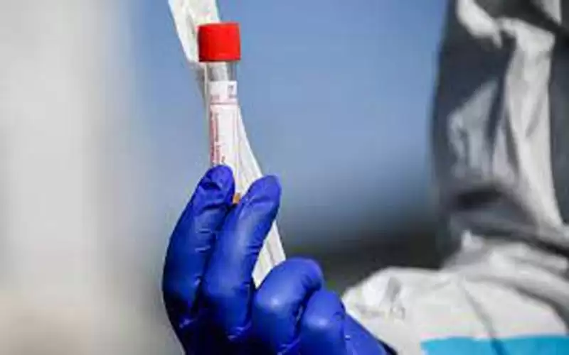 الأردن الـ 41 عالميا بإصابات كورونا