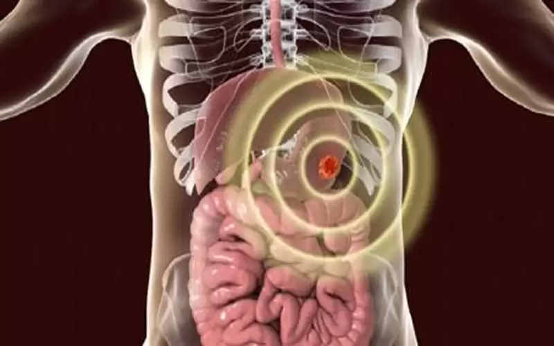نوع من الخضراوات يزيد خطر الإصابة