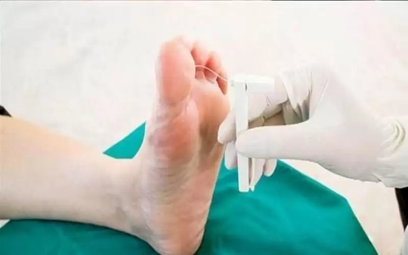 نصائح لتحمى نفسك من القدم السكري