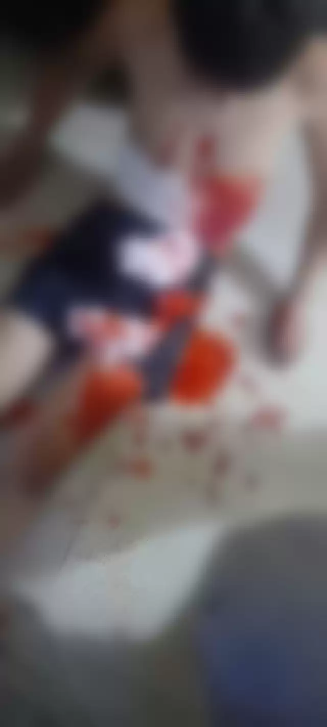 حين يثور الأردن بـعلبة كاتشاب