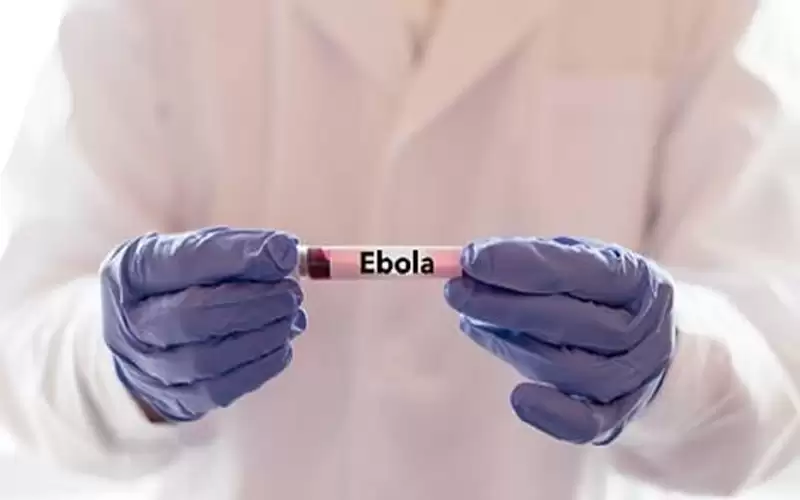 تسجيل ثالث وفاة بحمى إيبولا بالكونغو