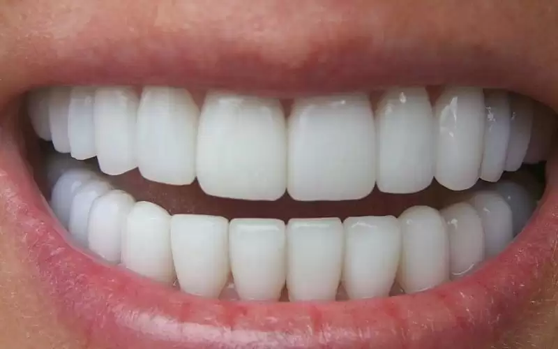 لمريض السكري.. 4 عادات تدمر أسنانك