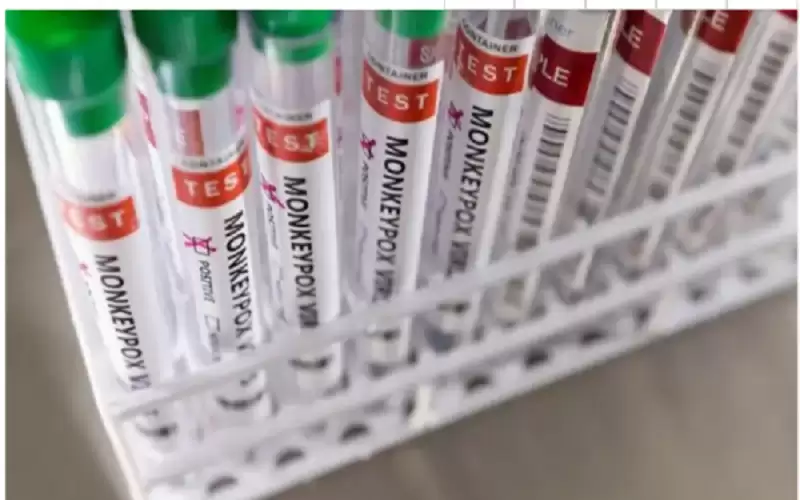 كيف تختلف عدوى جدري القرود عن