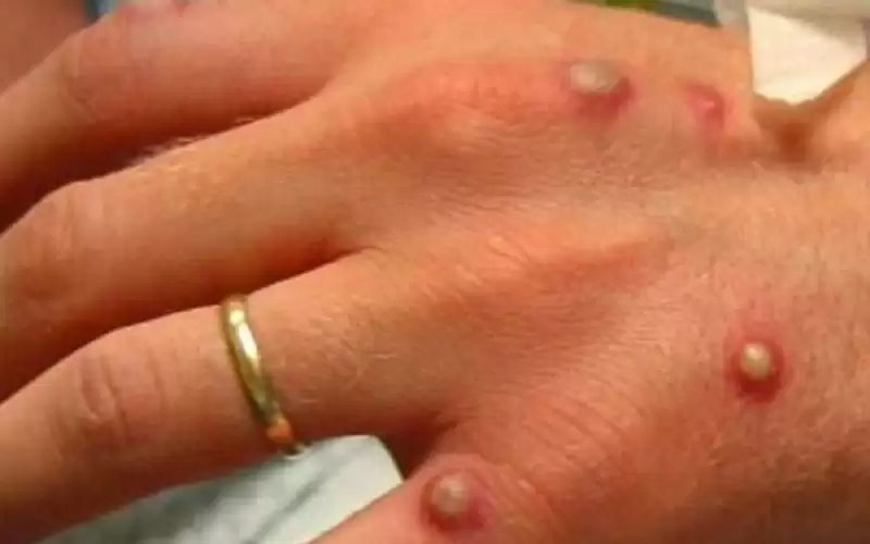 قلق جديد .. هذه الأشياء قد