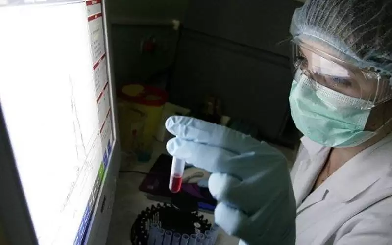 أكثر من 1000 إصابة بجدري القردة