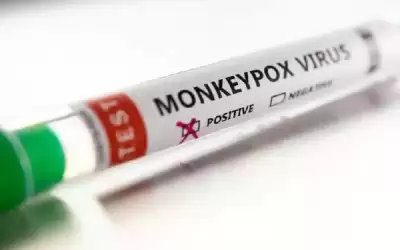 كندا: رصد 100 إصابة بفيروس جدري