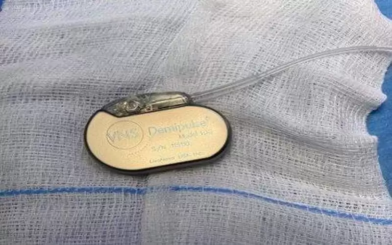 زراعة بطارية محفزة لطفل في البشير