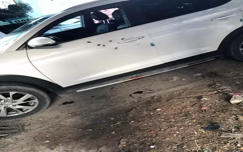 إصابة نائب رئيس الوزراء الفلسطيني الأسبق