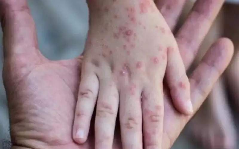 إعلان حالة الطوارئ في نيويورك