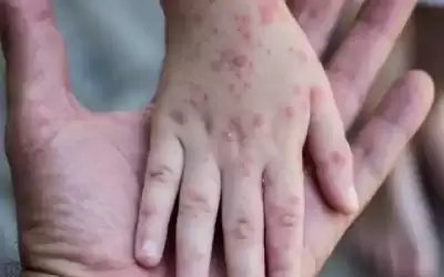 إعلان حالة الطوارئ في نيويورك