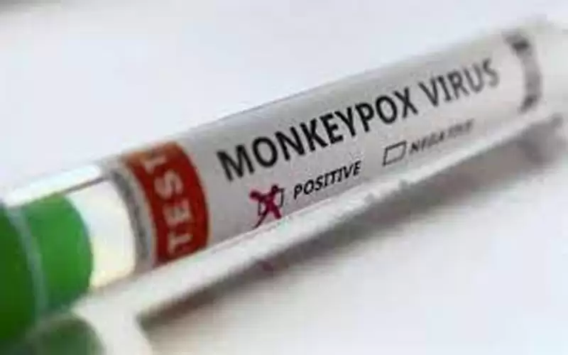 الهند تعلن أول وفاة بجدري القرود