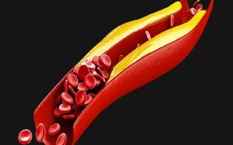 الكوليسترول الضار والتغذية الصحية