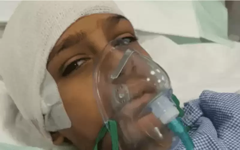 طالب يكسر جمجمة زميله في مدرسة