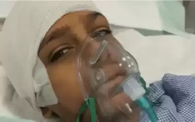 طالب يكسر جمجمة زميله في مدرسة