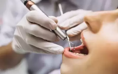 نقابة أطباء الأسنان: نسبة البطالة تجاوزت