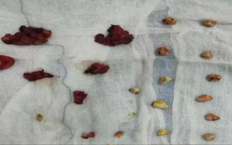 في حادثة غريبة بمصر.. استخراج 49