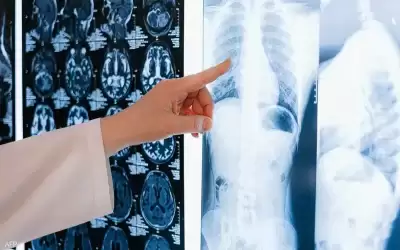تقنية جديدة ترفع آمال الشفاء من