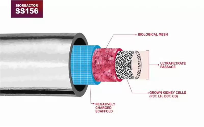فلتر حيويا يبعث الأمل لمرضى الكلى