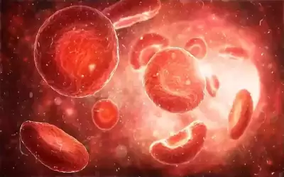 نقص الحديد في الجسم.. الأعراض والأسباب