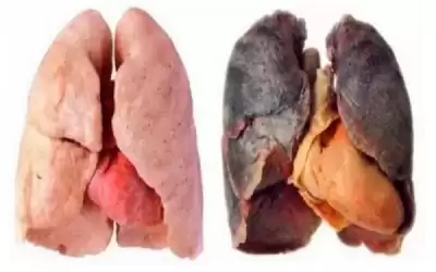 أضرار التدخين على الجهاز التنفسي