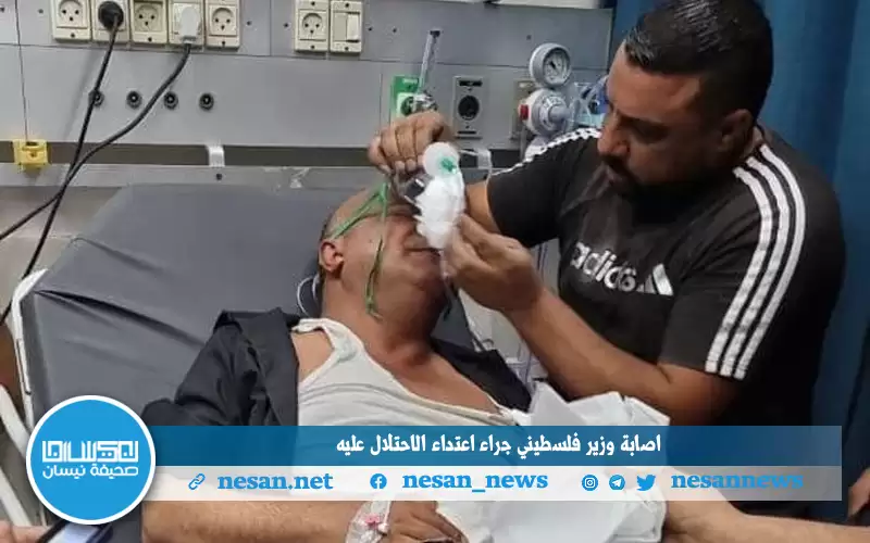 إصابة وزير فلسطيني جراء اعتداء الاحتلال