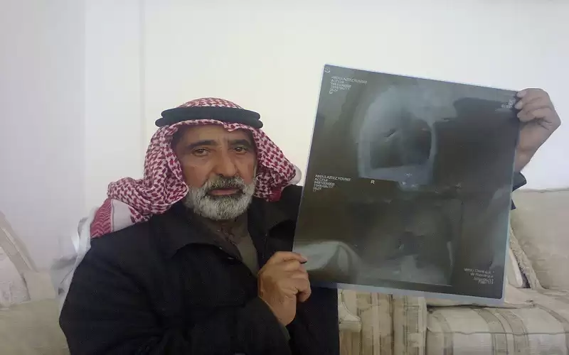 العدوان: قاتلنا ببسالة في معركة اليامون