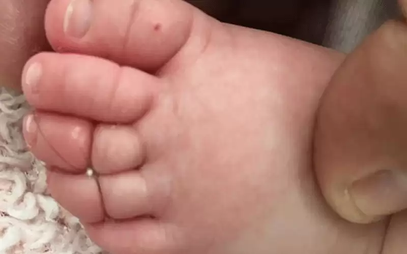 الأردن.. شعرة من رأس أم كادت